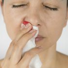 Spiritual Biblical Meaning of Nose Bleeding in a Dream