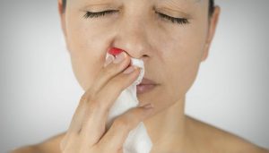 Spiritual Biblical Meaning of Nose Bleeding in a Dream