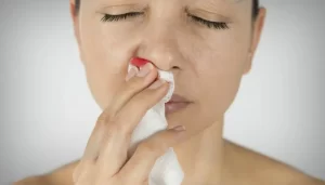 What Does Nose Bleeding in Dreams Mean? Biblical Spiritual Symbolism