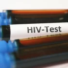 Spiritual Biblical Meaning of AIDS / HIV Positive in a Dream