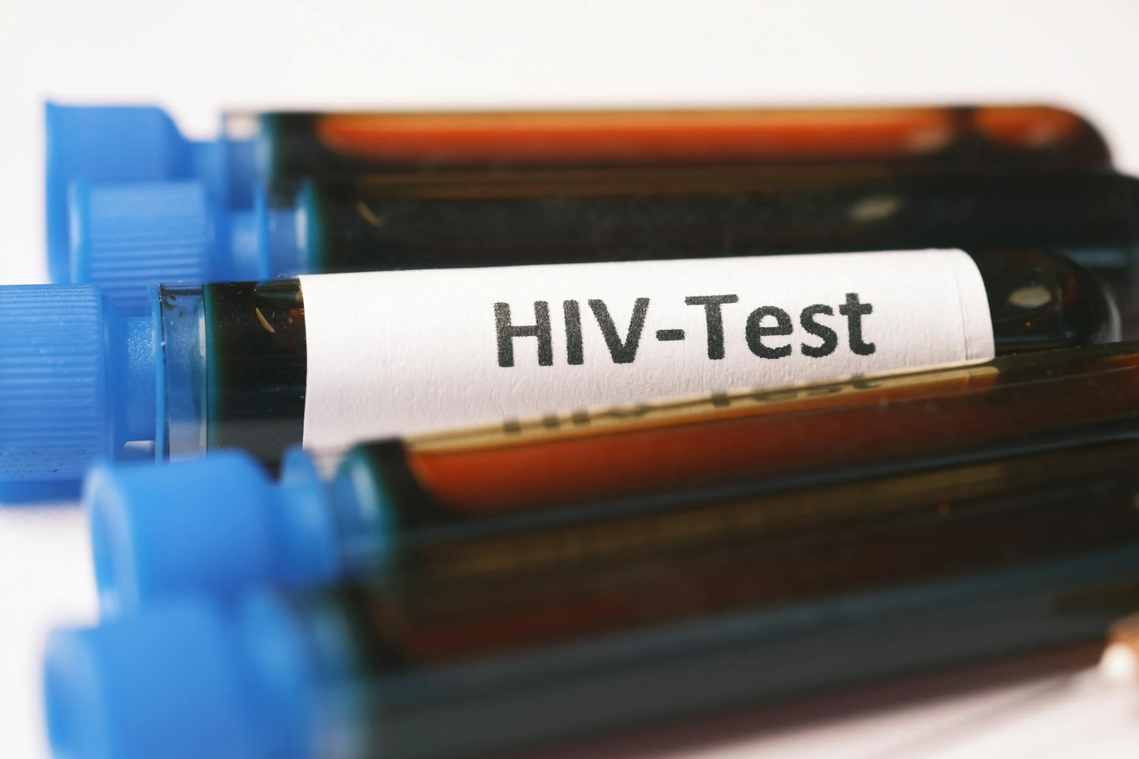 Spiritual Biblical Meaning of AIDS / HIV Positive in a Dream