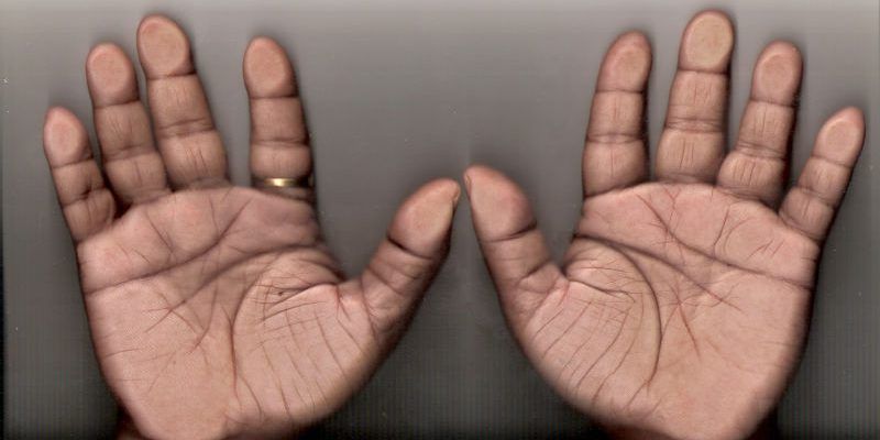 What Lines on the Palm Are Responsible for Love and Marriage?