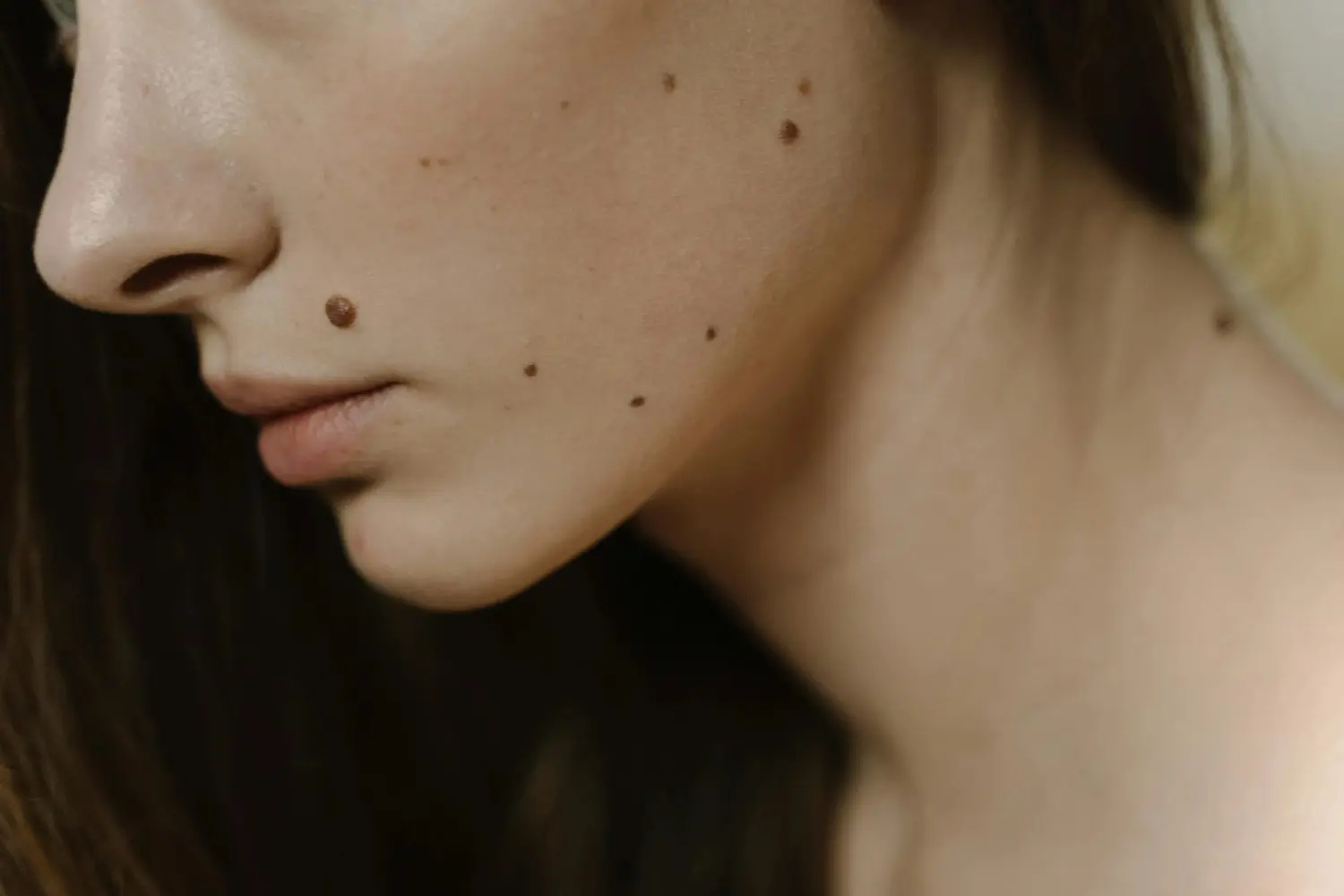 Do You Have a Mole on Your Neck? Unveiling Numerology and Astrology Secrets